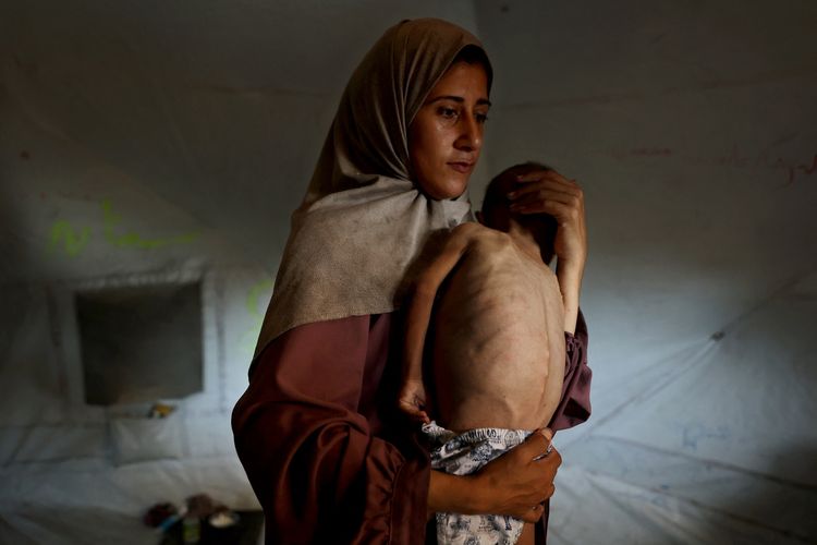 Usai Akui Palestina, Negara Barat Tawarkan Bantuan untuk Pasien Gaza
